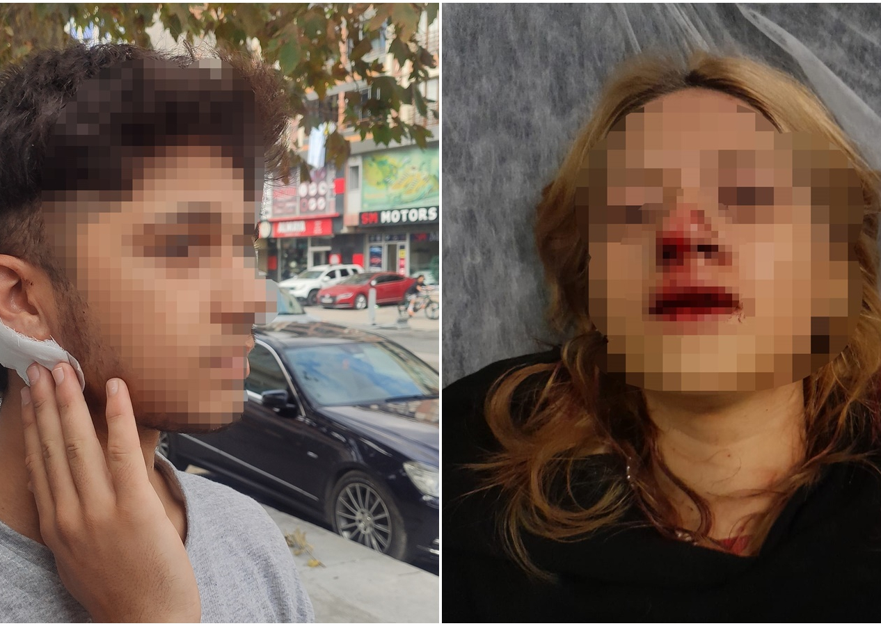 Bir grup saldırgan parkta oturan gençlere dehşet dolu anlar yaşattı: Talihsiz kızın yüzüne kaldırım taşı atarak dişlerini kırdılar! Erkek arkadaşının kulağını kestiler