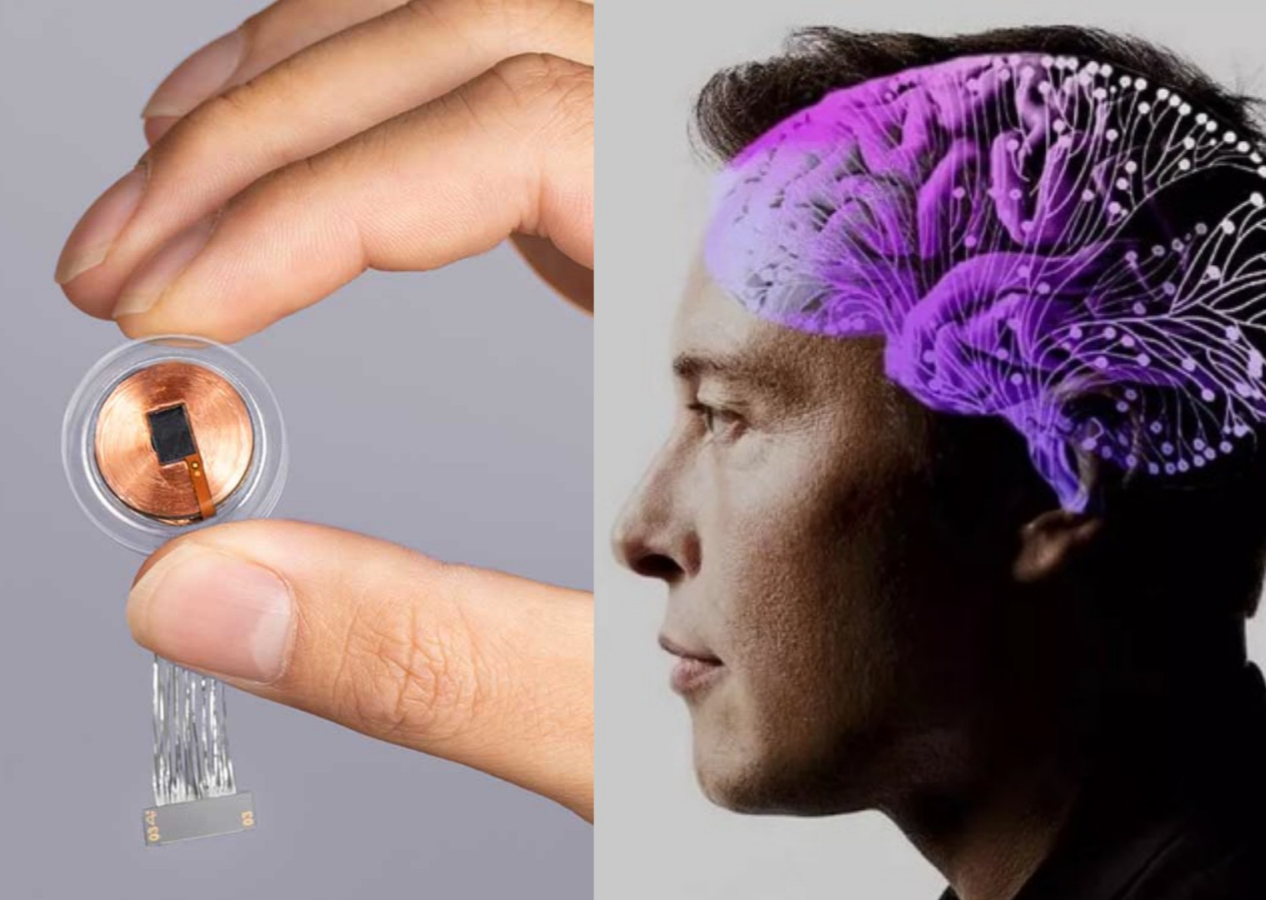 Elon Musk'ın tartışmalı beyin çipi için insan deneyleri başlıyor!