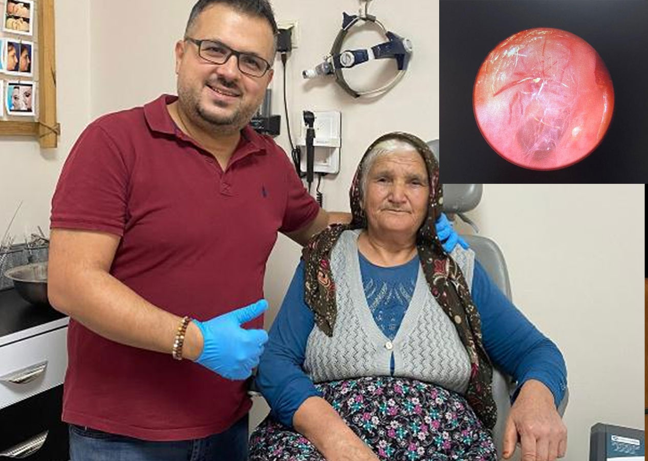 Kulağından ses gelme şikayetiyle doktora gitti! Canlı örümcek çıktı!