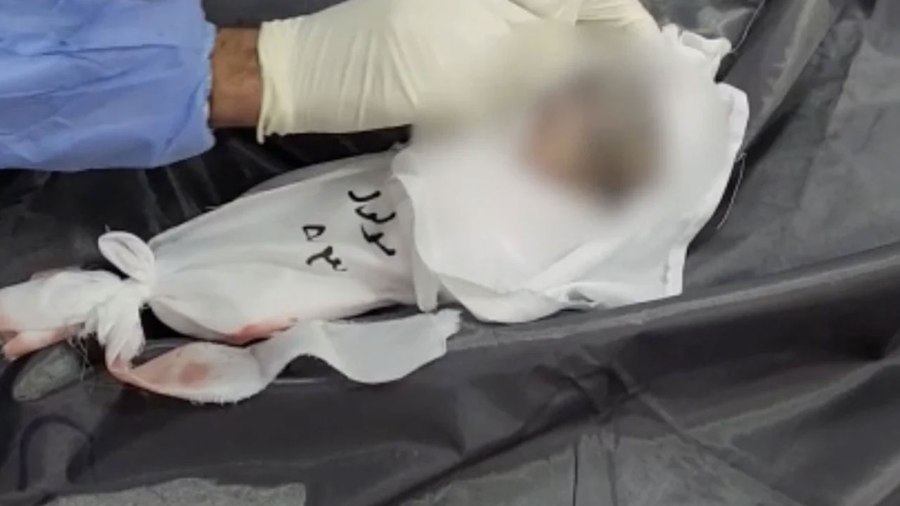 Bunun adı vahşet: İsrail Gazze'de anne karnındaki ikiz bebekleri de öldürdü!