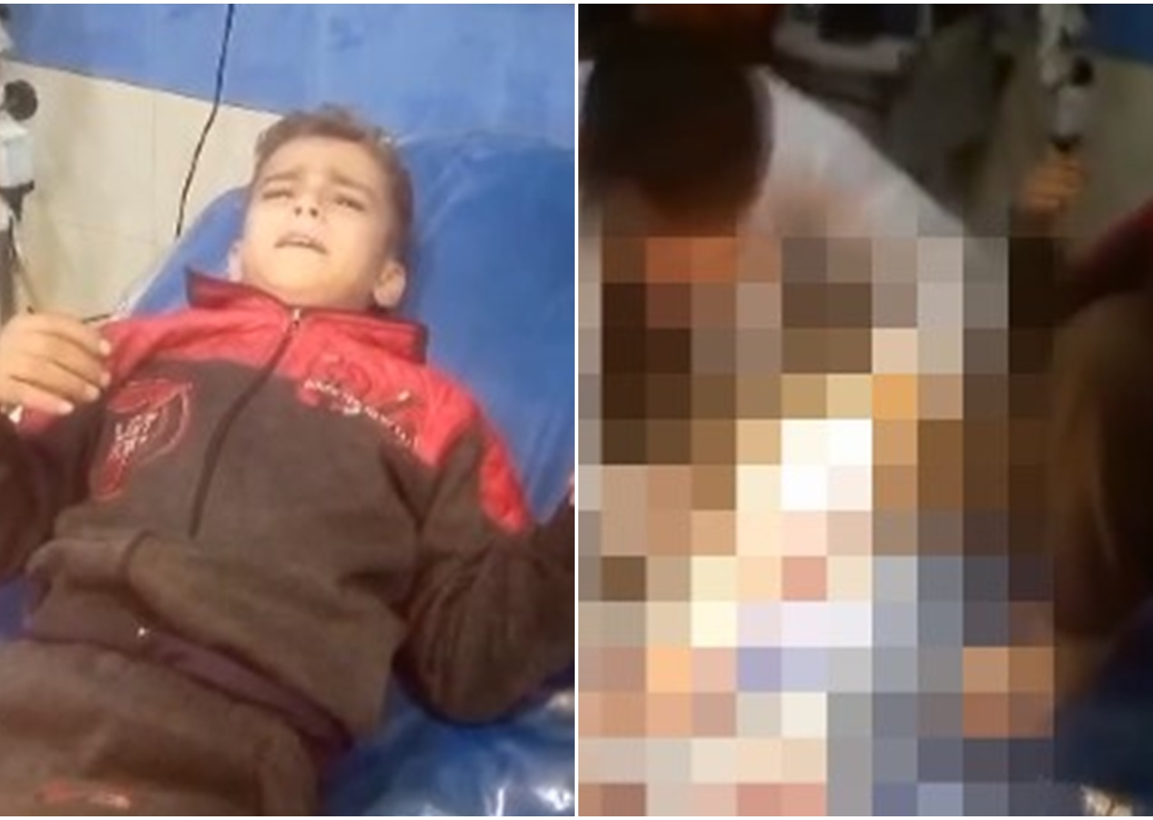 İsrail'in zulmü bitmiyor! Saldırılarda yaralanan Gazze'li çocuk anestezisiz ameliyat olmanın acısına dayanabilmek için bakın ne yaptı