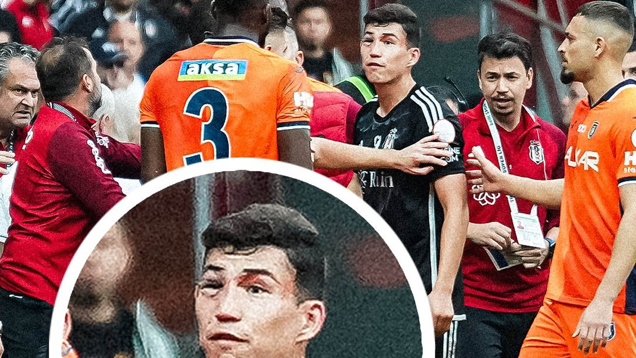 İzleyenler şok oldu! Beşiktaş'ta Bahtiyar Zaynutdinov oyuna devam edemedi