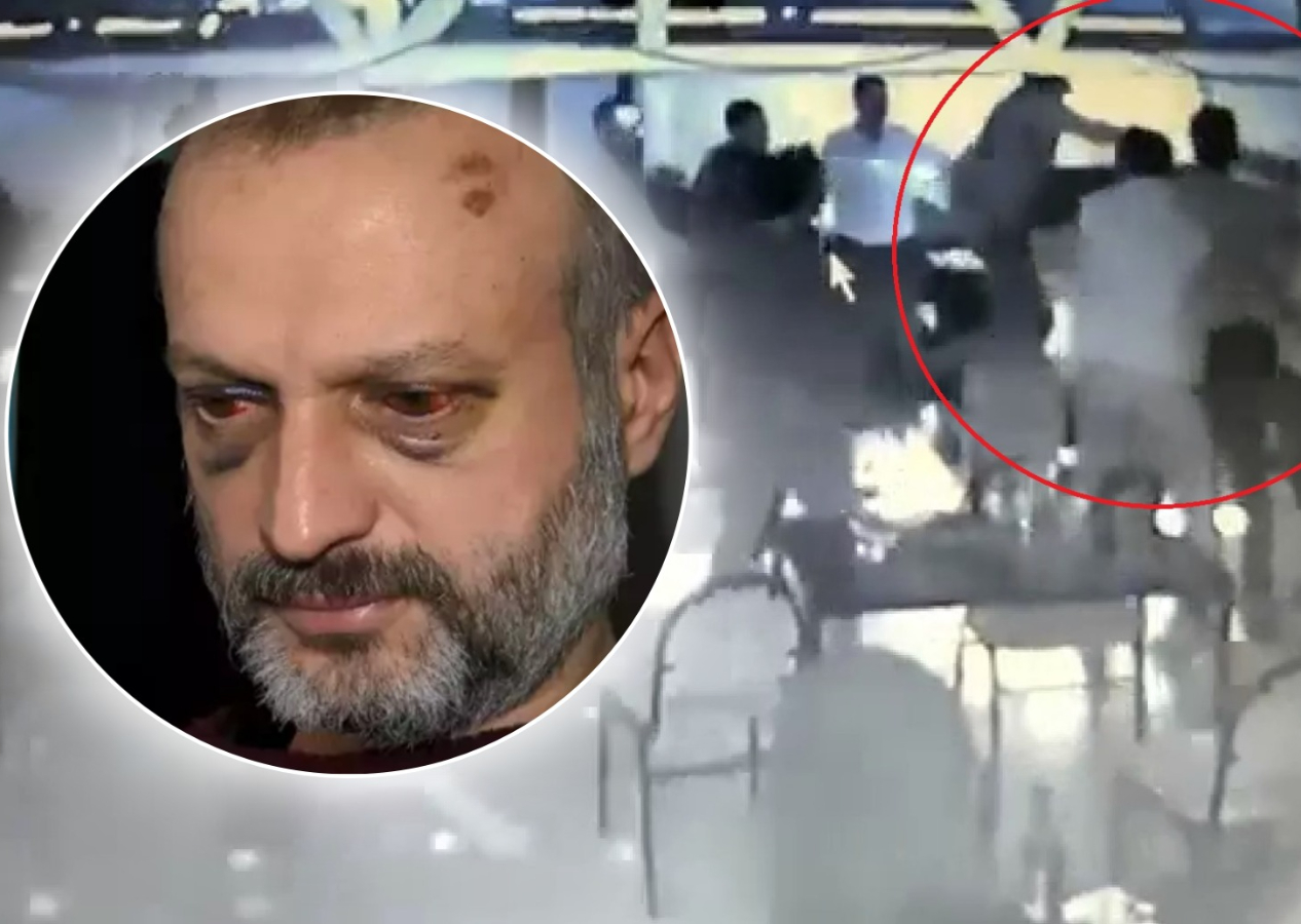 ‘Çiftetelli’ çalmadı diye öldüresiye dövdüler: "Hayvanca saldırdılar"