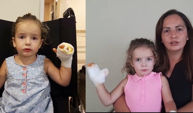 Bomba gibi patlayan uçan balon küçük Mira'yı hastanelik etti...