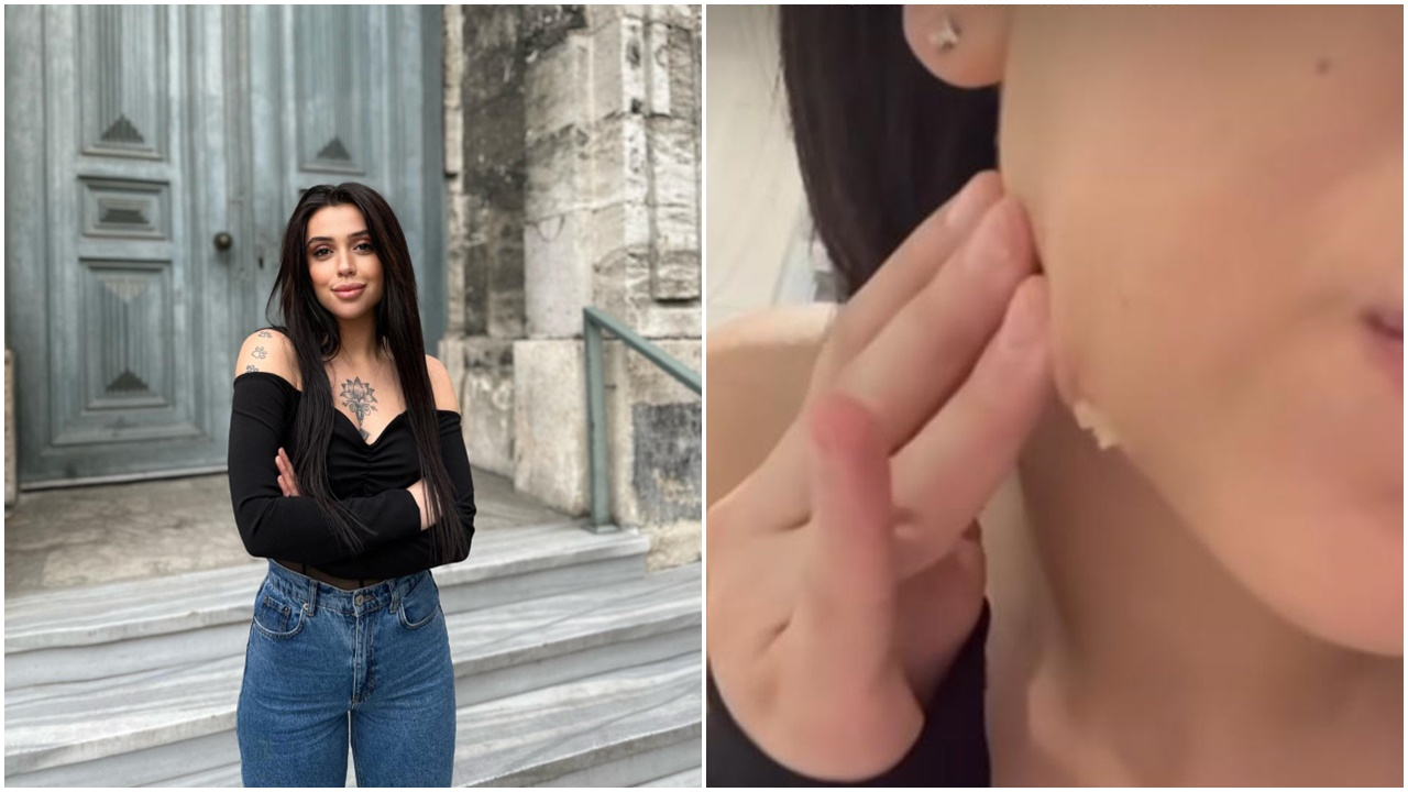 Kısmetse Olur Aşkın Gücü yarışmacısı Simge Nur Erkoç, estetik kurbanı oldu! Yüzünden akanları görenler şaşkına döndü