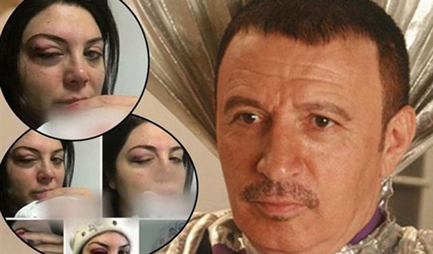Yenilen dayak unutuldu! Mustafa Topaloğlu ile Derya Topaloğlu barıştı...