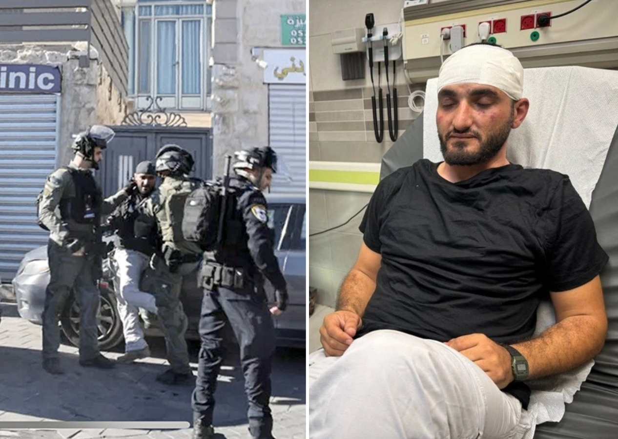 İsrail polisinin saldırdığı AA muhabiri hastaneye kaldırıldı! Silahla vurup yerde tekmeler attılar..