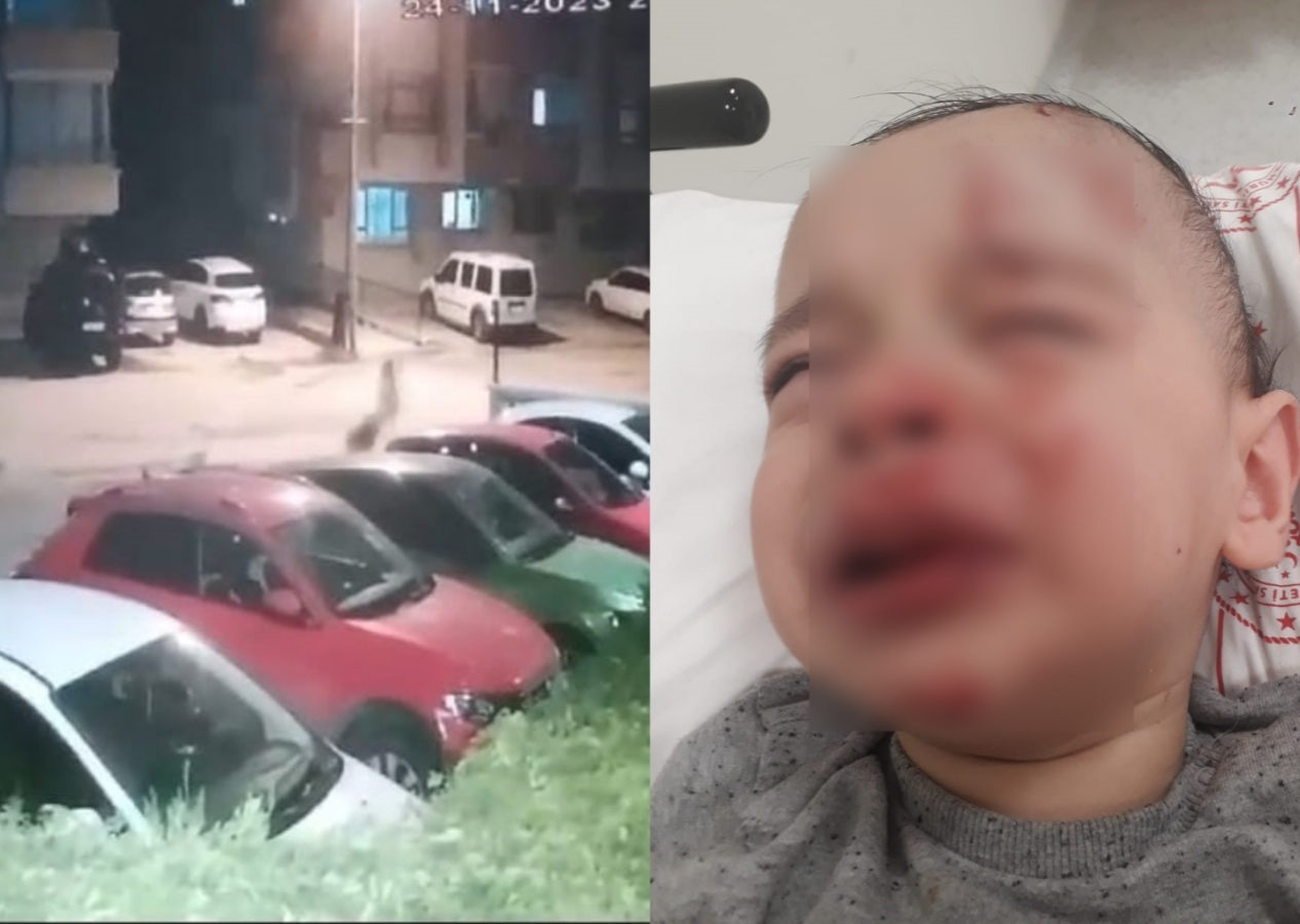 Sokak köpeği dehşeti: Kızını köpeklerden korumaya çalışan baba, kucağındaki bebeğiyle birlikte yere düştü! Feci şekilde yaralandılar...