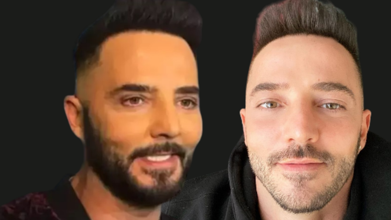 Gökhan Özen'in yüzündeki değişim sosyal medya kullanıcılarının dilinde!