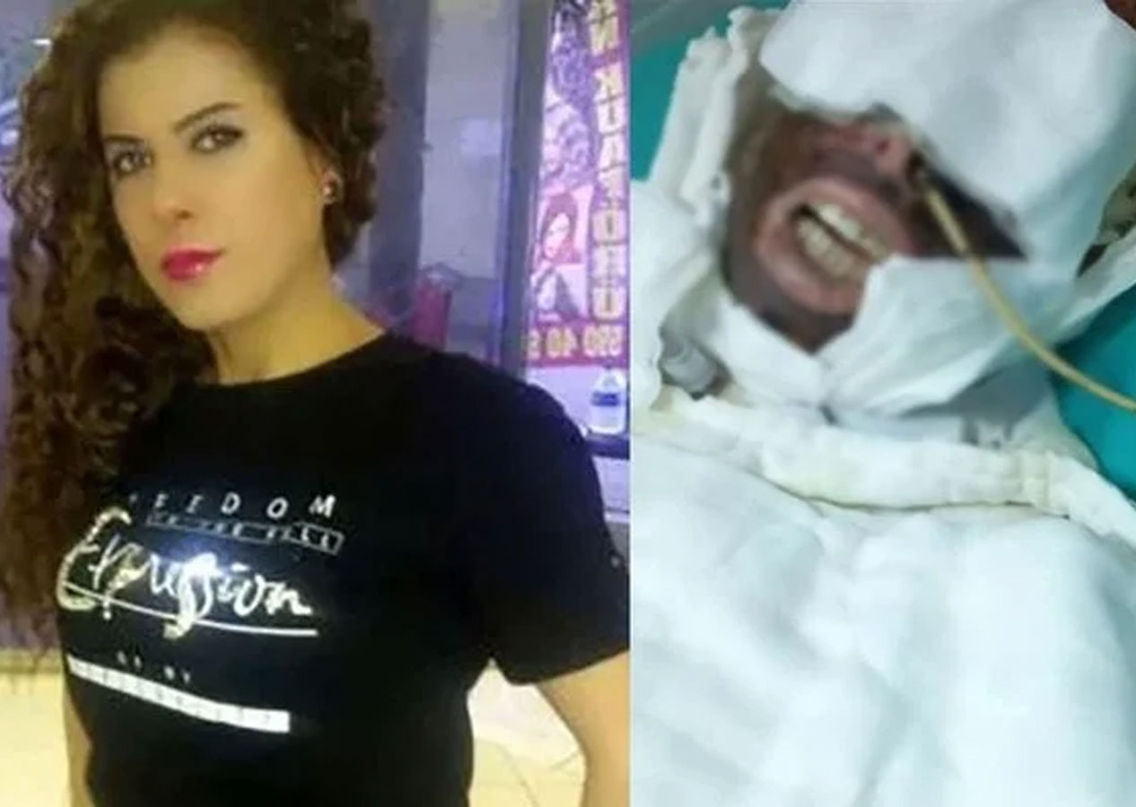 Yasemin Uzunçelebi'ye kimyasal madde atan cani hakkında karar!