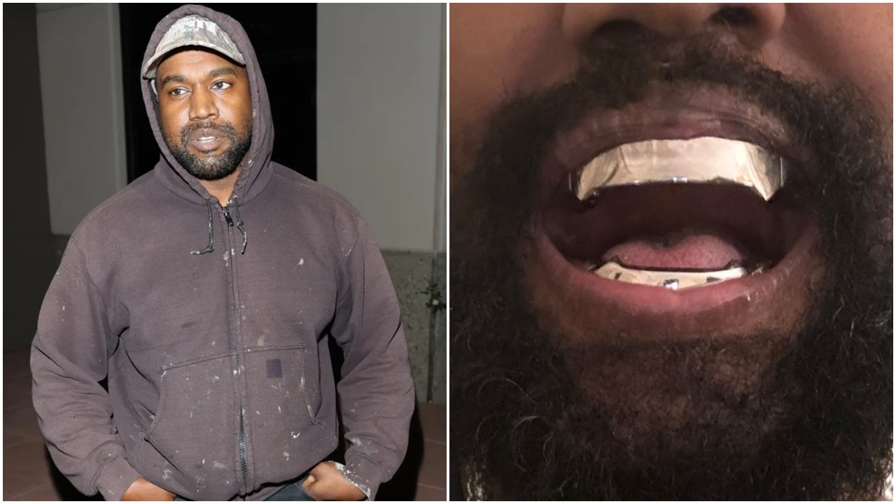 ABD'li sanatçı Kanye West'in 850 bin dolarlık titanyum protez dişleri gündem oldu!