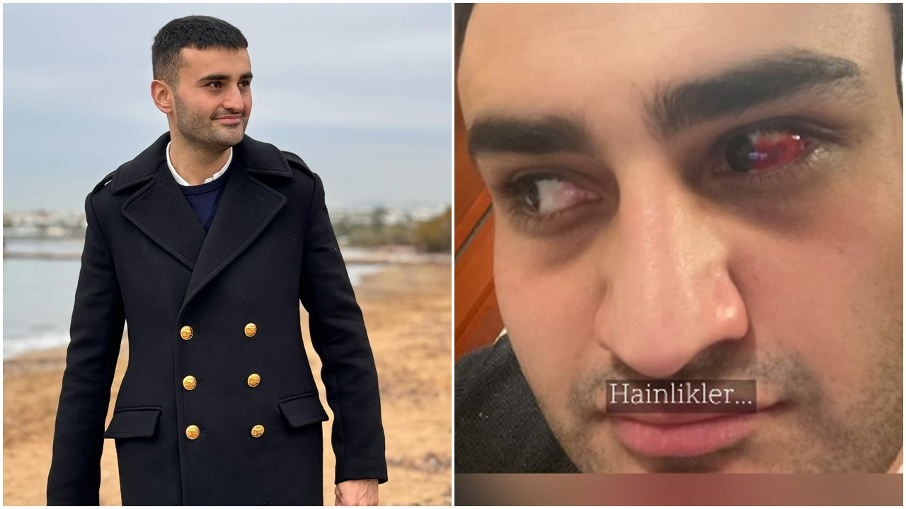 CZN Burak paylaşımıyla korkuttu! Yüzü, gözü yara içinde