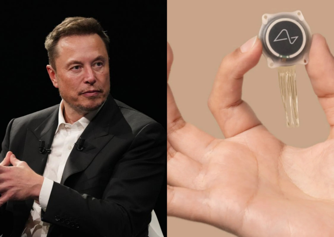 Çok tartışılıyordu! Elon Musk'ın istediği oldu ve ilk kez insan beynine çip yerleştirildi