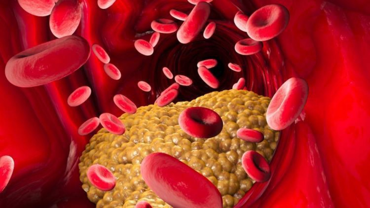 Trigliserid nedir? Trigliserid düşüklüğü ve yüksekliği nedenleri...