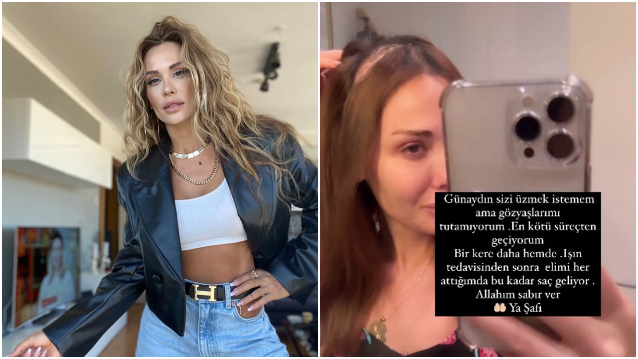 Meme kanserini yenip beyin tümörüne yakalanmıştı! Işın tedavisi gören şarkıcı Şimal dökülen saçlarını paylaştı: Gözyaşlarımı tutamıyorum