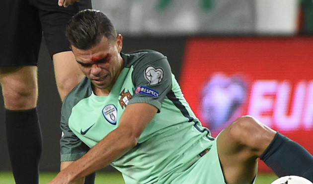 Pepe kanlar içinde yere yığıldı!