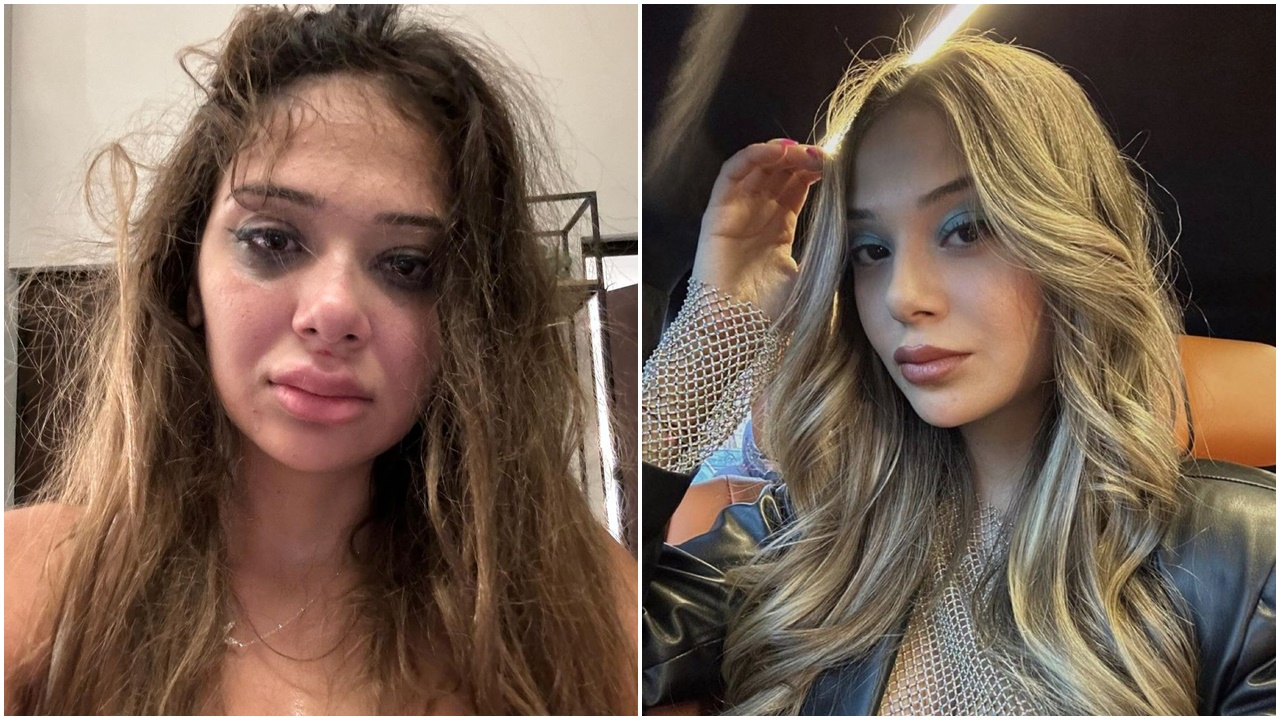 Onlyfans fenomeni Merve Taşkın, eski sevgilisi tarafından öldüresiye dövüldü! ''Cinsel organımı tekmeliyordu''