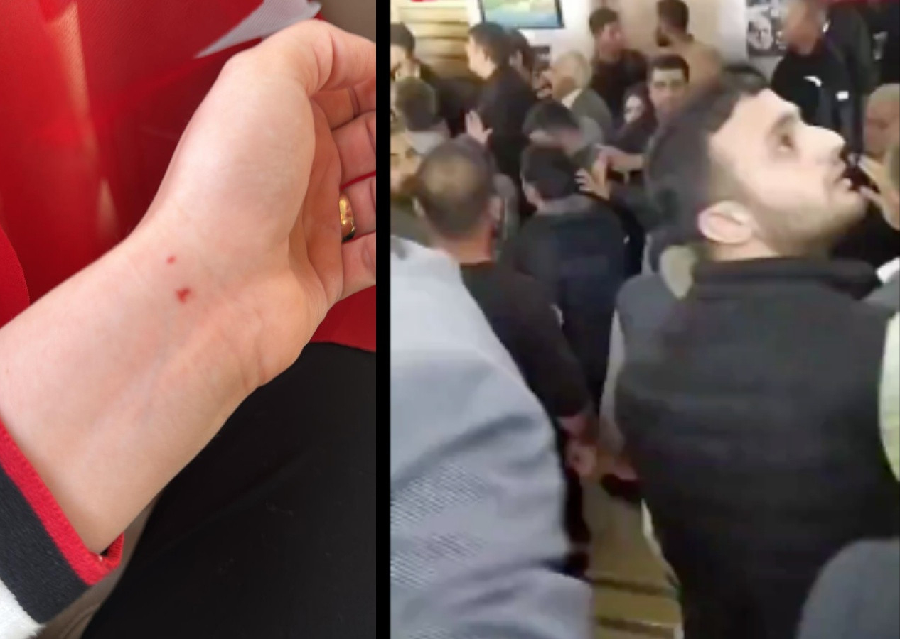 DEM Partililer AK Parti Belediye Başkanına saldırdı! "Oy kullanmamıza engel olmak istediler"