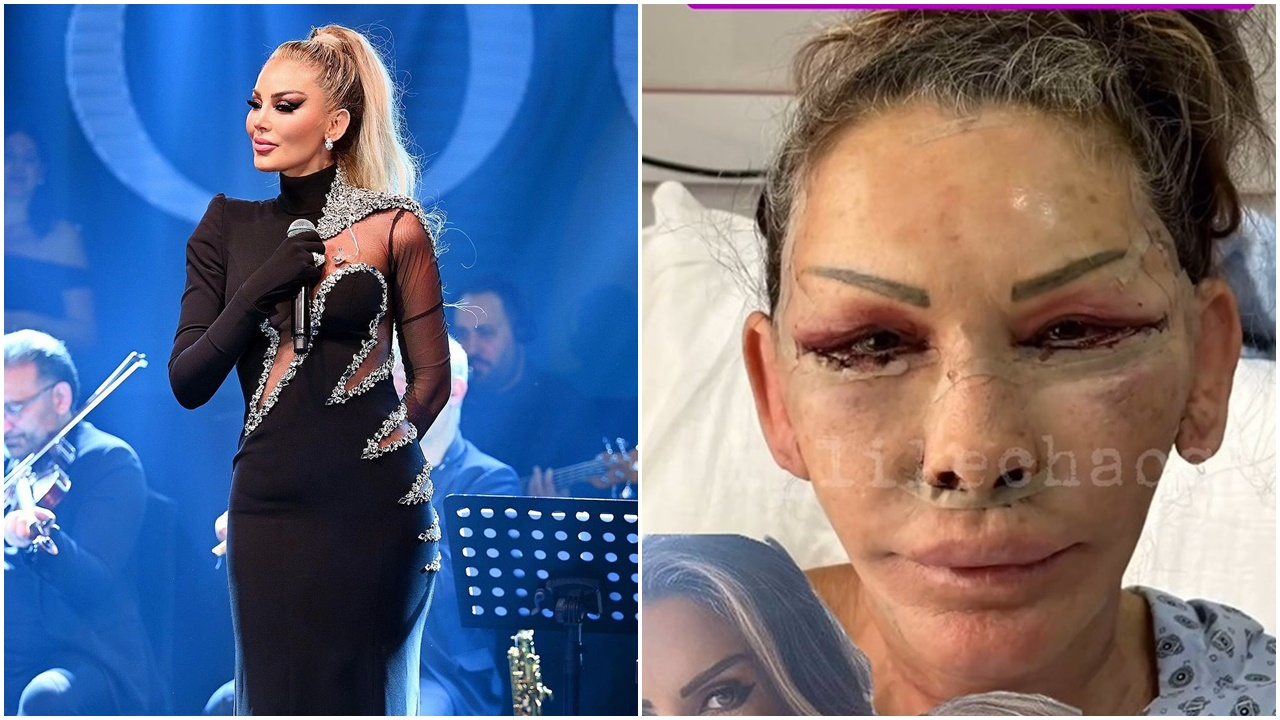 Petek Dinçöz'ün annesi yüz gerdirme ameliyatı oldu! Yeni hali şaşkına çevirdi