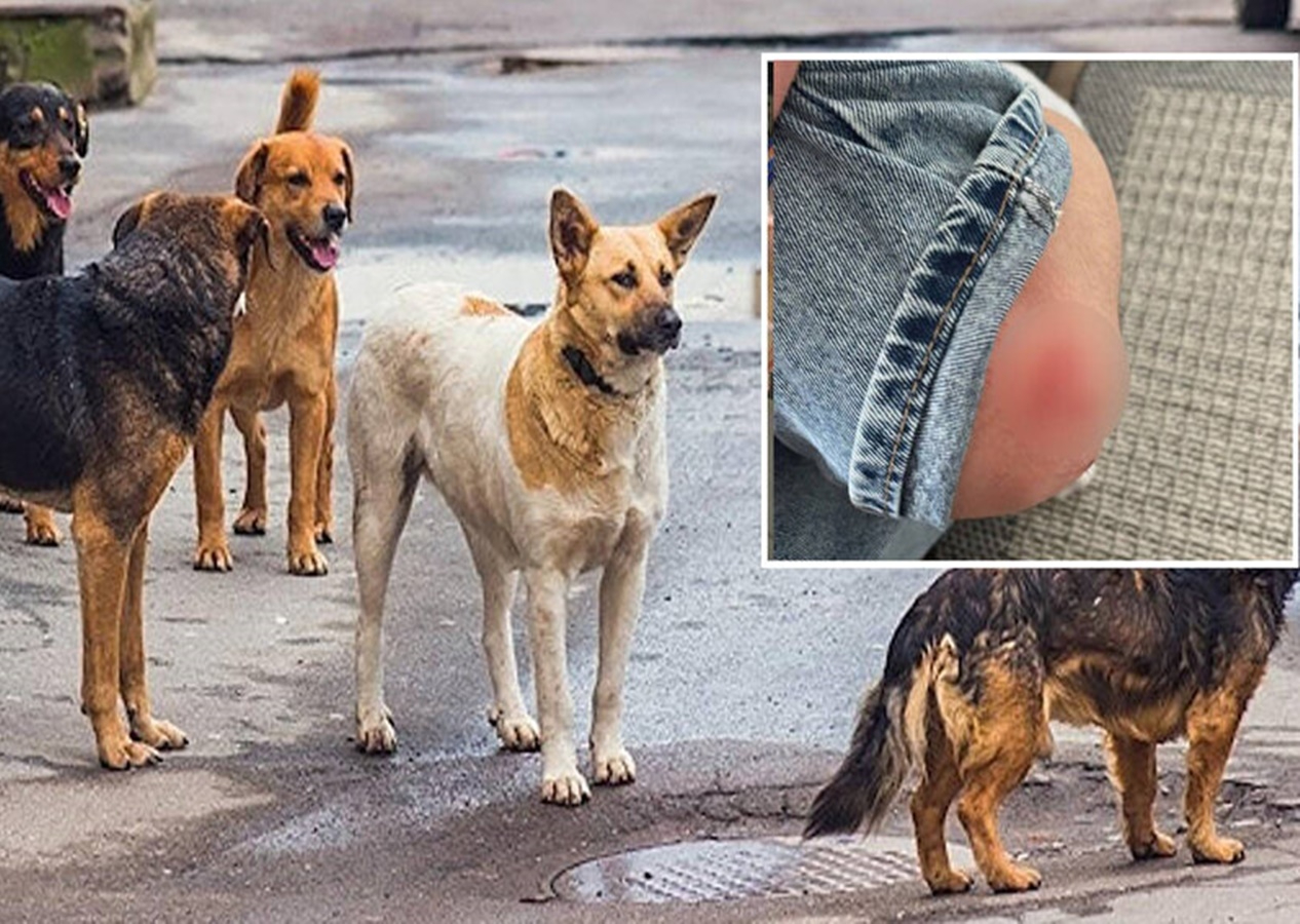 Ankara’da 15 yaşındaki çocuğa sokak köpekleri saldırdı