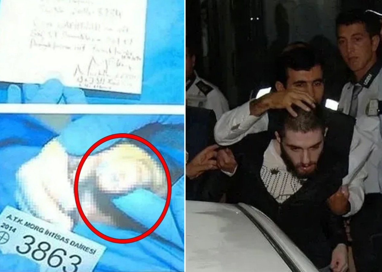Cem Garipoğlu'nun otopsi fotoğraflarında dikkat çeken detay! Ellerindeki mor lekelerin sırrı çözüldü...