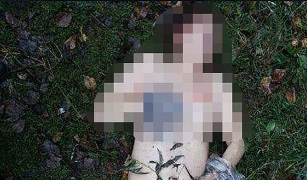 Rusya’da ‘yamyam cerrah’ korkusu!