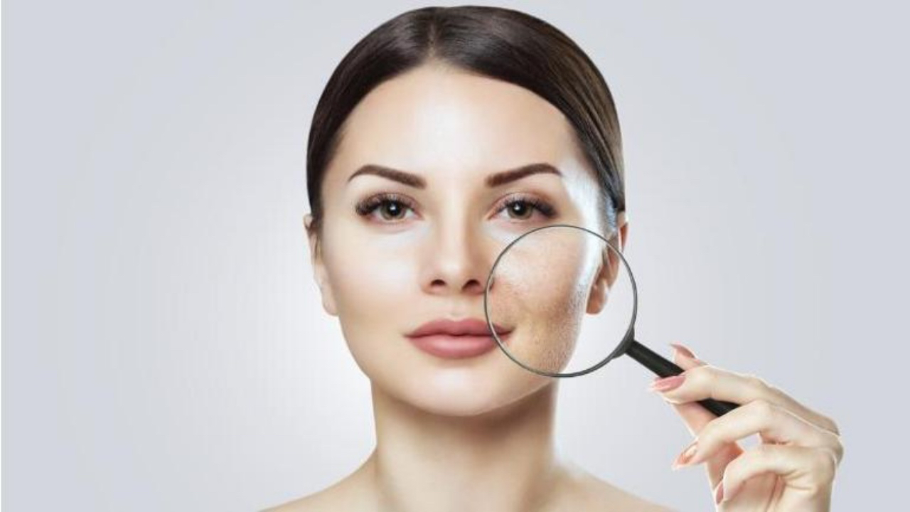 Niacinamide nedir? Ne işe yarar?