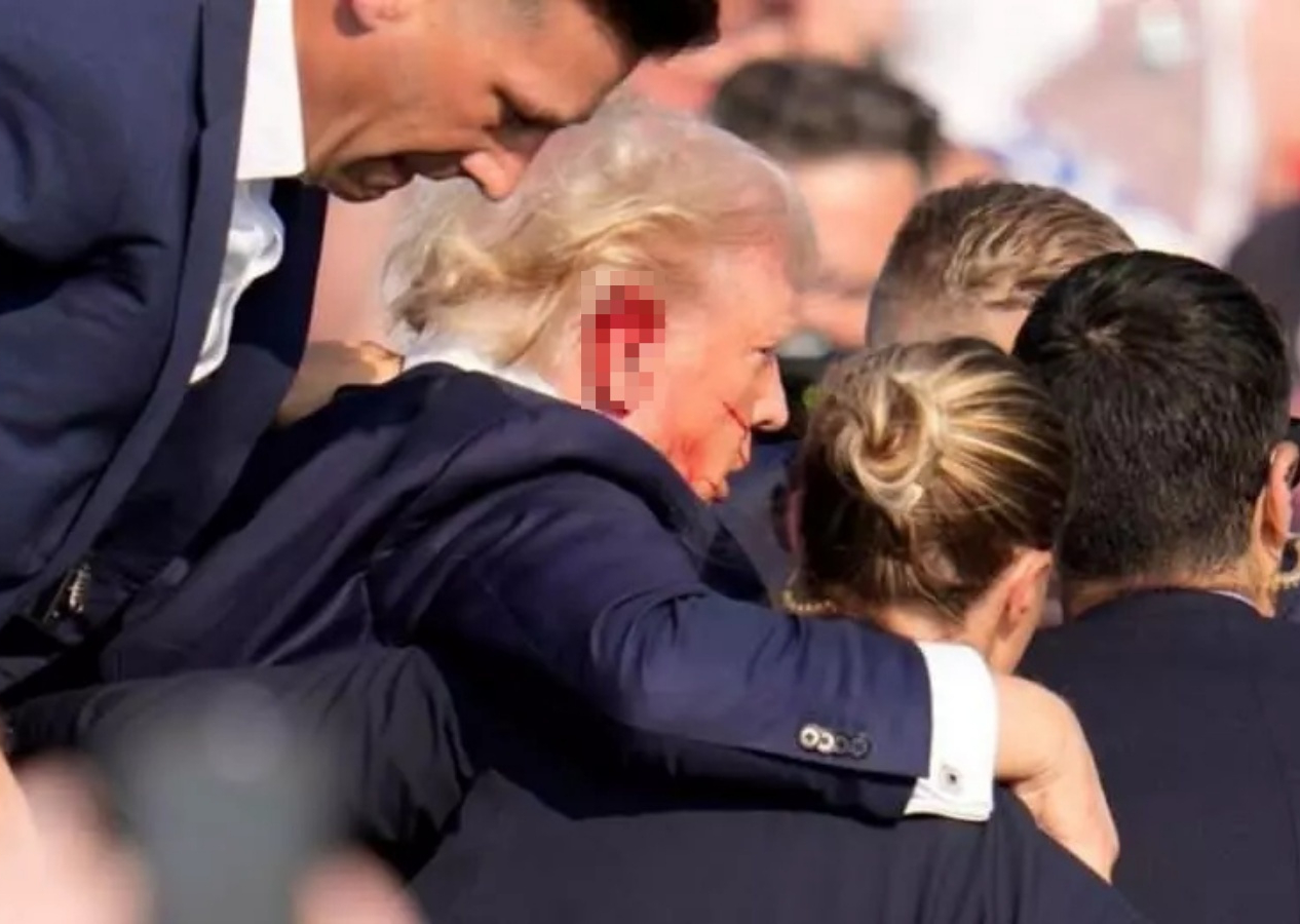 Trump, suikast girişimi sonrası ilk kez bandajsız görüntülendi! Yeni iddialar kafaları karıştırdı...