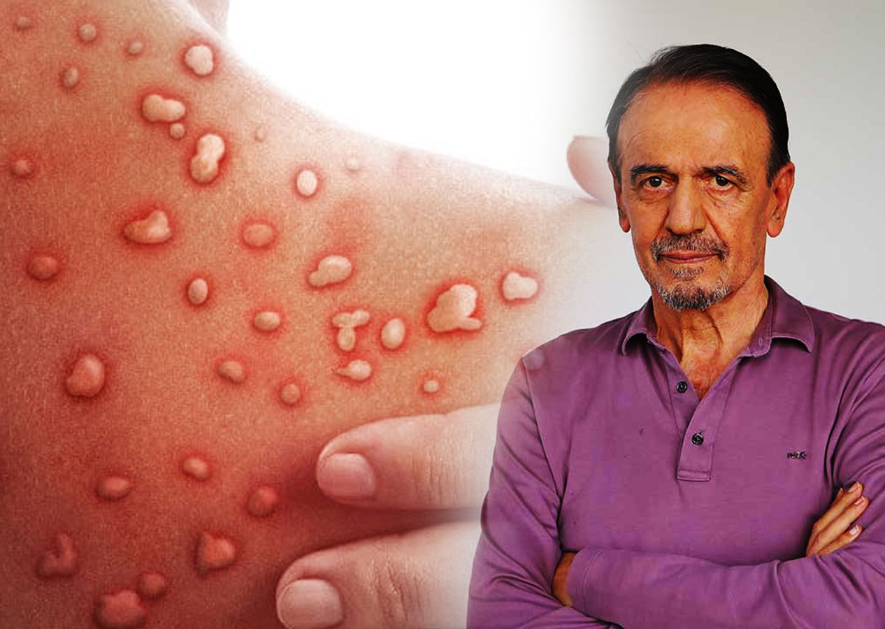 Tartışılan Profesör Ceyhan yeniden televizyonlarda: "Türkiye'de Maymun Çiçeği virüsü yok diyemeyiz"