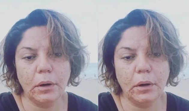 İzel: "O tokadı beni bitirmeye çalışanlara..."