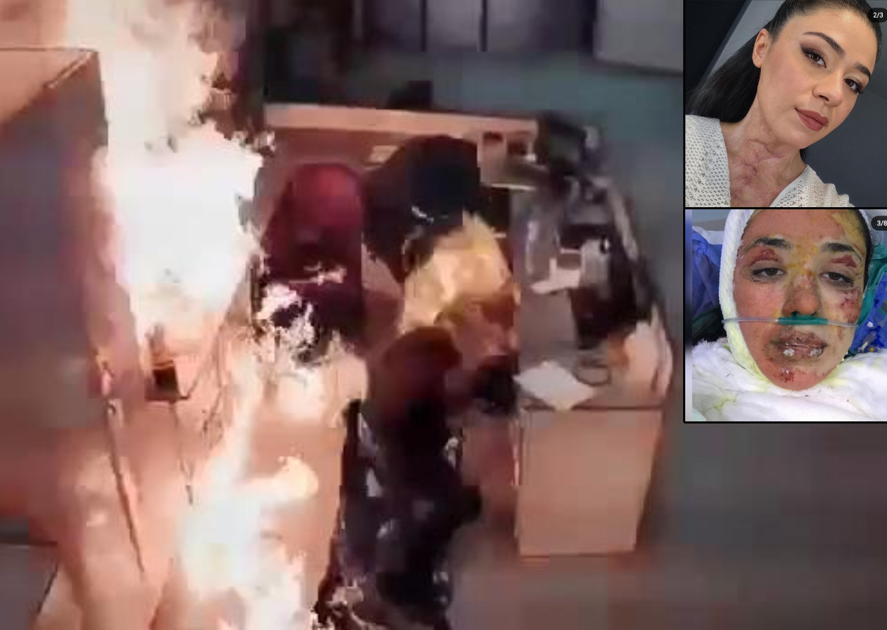 Erkek hemşirenin "Yakayım mı sizi" şakası faciaya dönüştü, meslektaşlarını hastanelik etti
