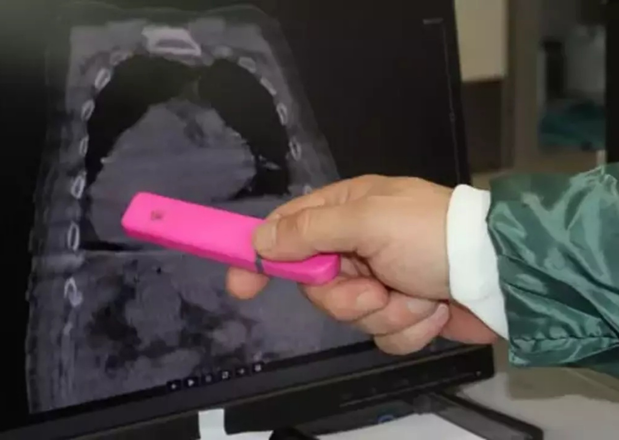Dünyada bir ilk! Tüm organları yer değiştiriyor... Hastalığa 'Giresun Sendromu' ismi verildi!