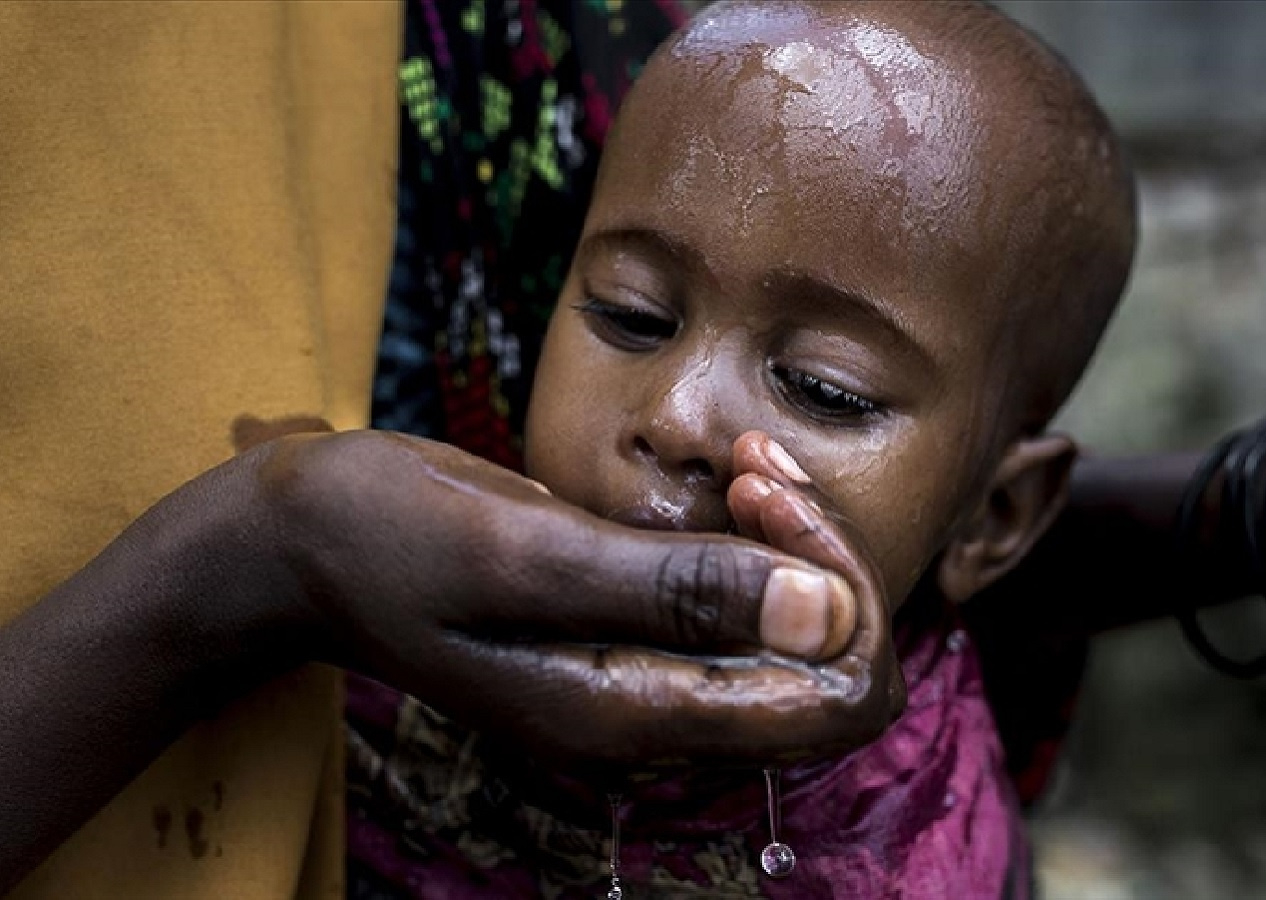 Sudan'da kolera salgını can aldı: Hayatını kaybedenlerin sayısı 672'ye çıktı...