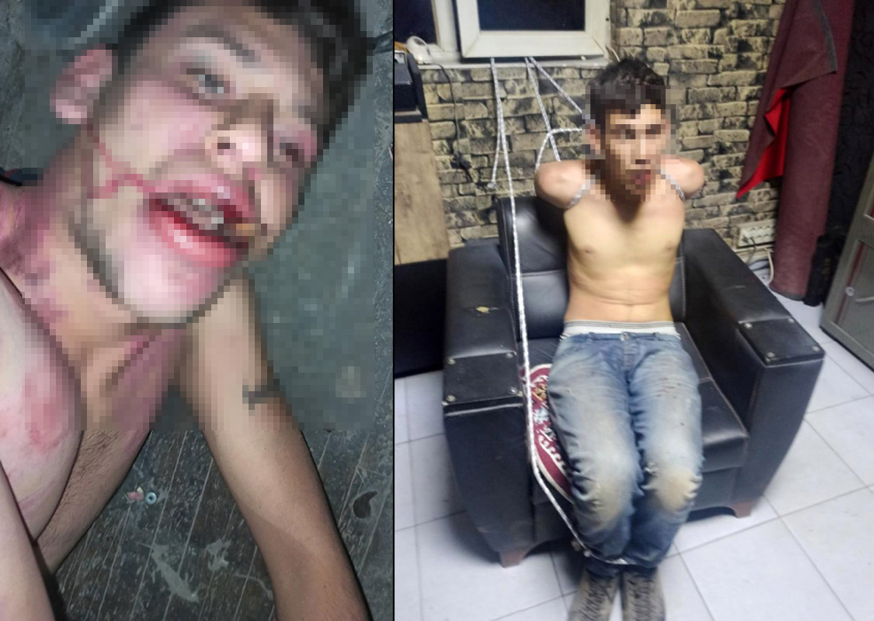 Patron tarafından alıkoyulan işçi 3 gün darbedildi, böcek yedirildi, dişleri kırıldı