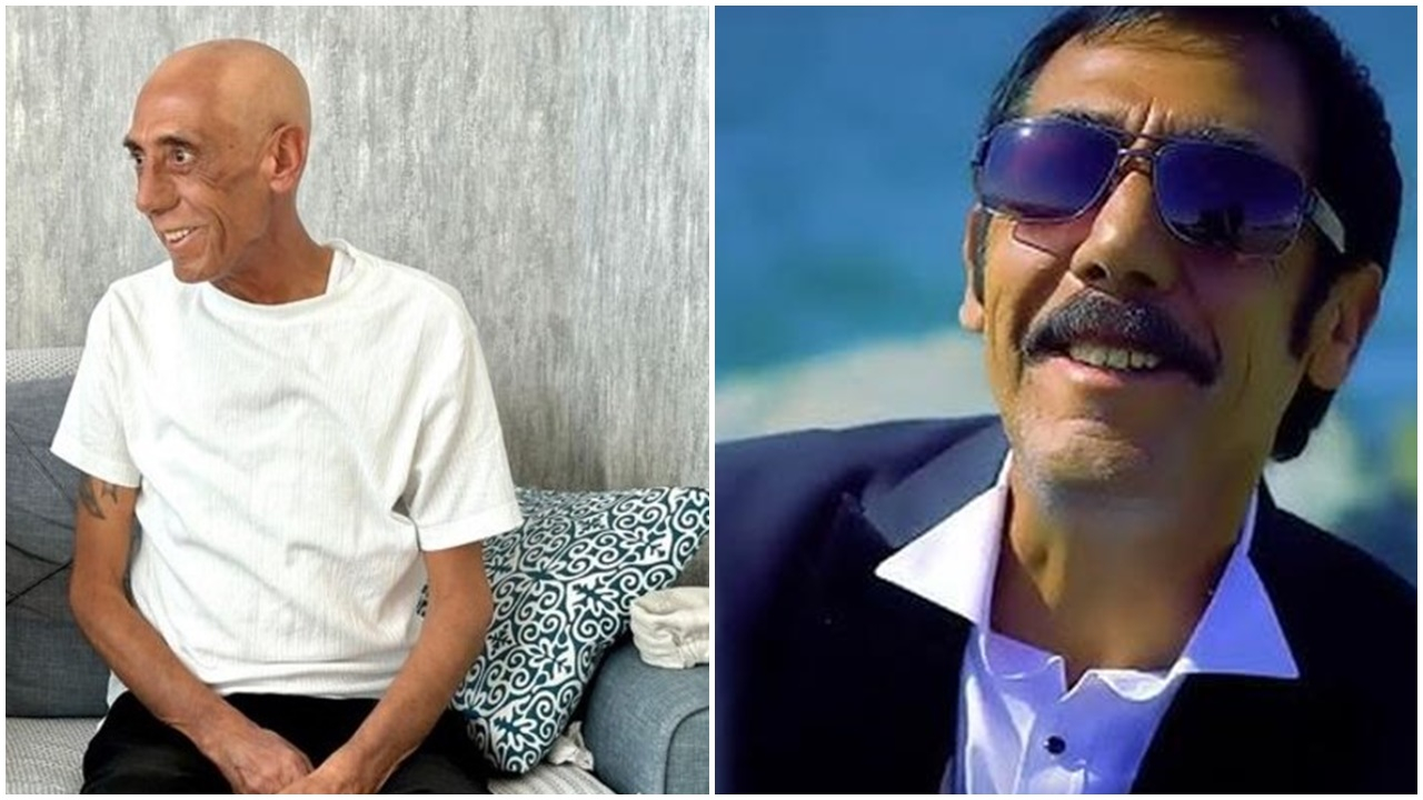 Kanserle mücadele eden Ankaralı Turgut'tan kötü haber