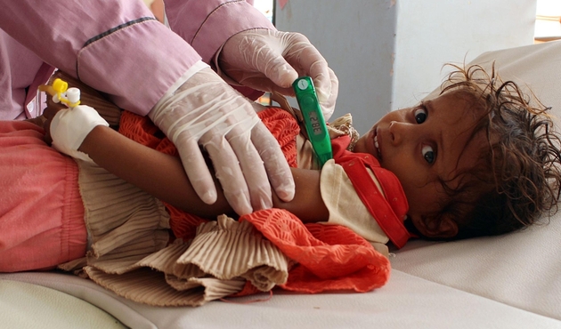 Oxfam: Yemen'deki, tarihin en büyük kolera salgını...