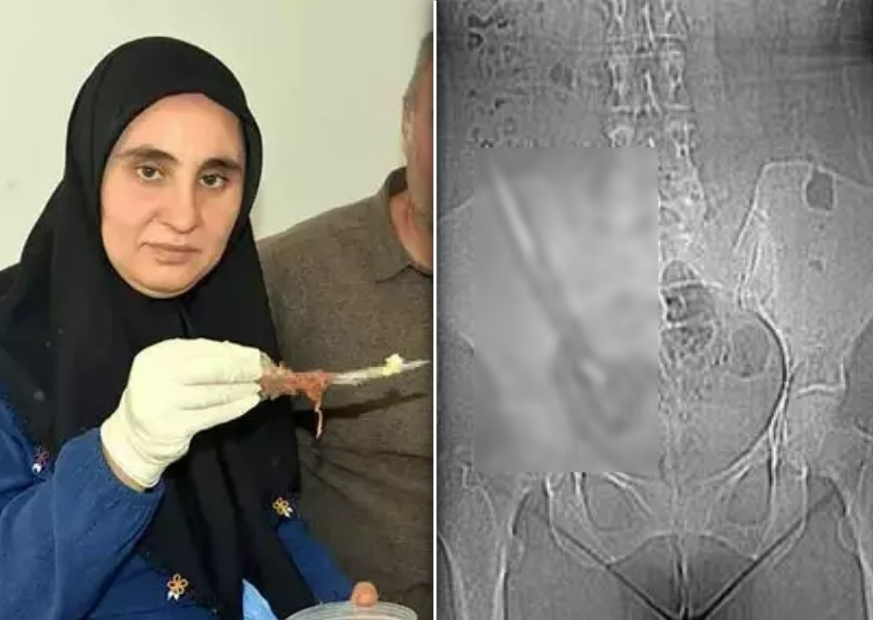 Baş ağrısı şikayetiyle hastaneye gitti, hayatının şokunu yaşadı! Görmeden inanamadı!