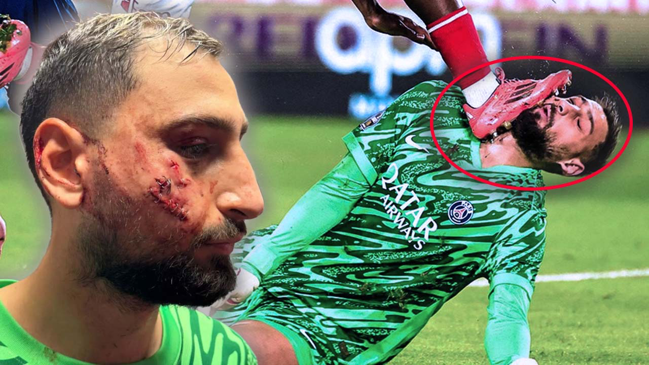 Kan donduran görüntü! Gianluigi Donnarumma'nın yüzü parçalandı, hakem pozisyonda sarı kart bile göstermedi