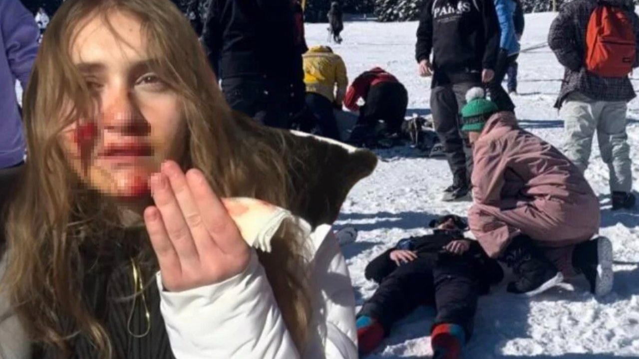 Uludağ'da zincirleme kayak kazası! Çok sayıda yaralı var