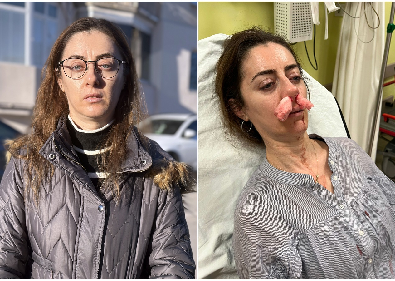 Sokakta gördüğü kadını eşinin sevgilisi sanınca bir anda saldırdı! Kafasını arabanın kapısına sıkıştırıp darp etti