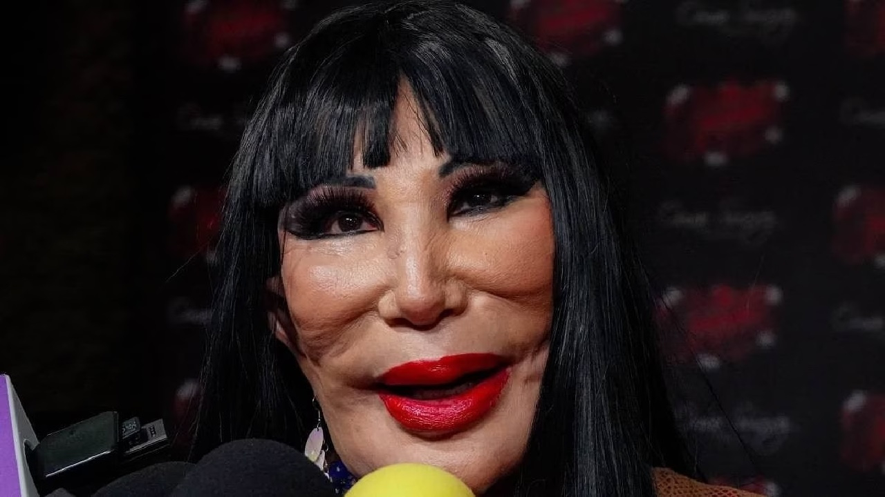 Lyn May'in yaşadığı korkunç olay: Yüzüne yemek yağı enjekte edilmesi