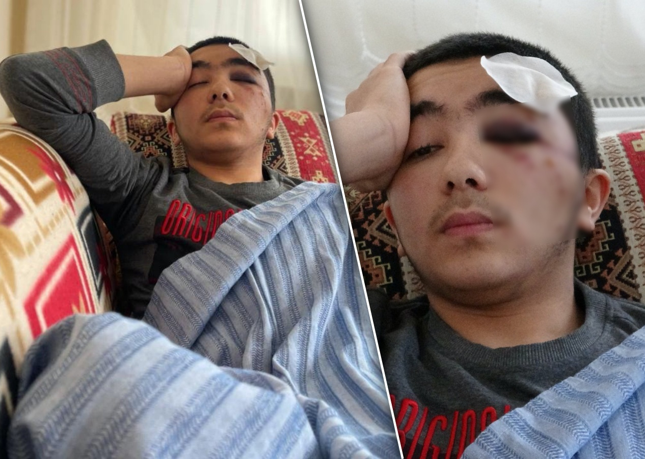 Başıboş köpek terörü! 16 yaşındaki hafız Salih Yıldırım ölümden döndü... Kafatası çatladı!