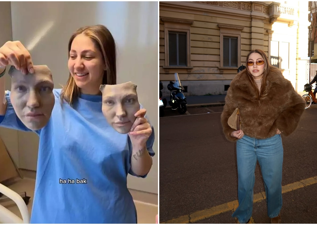 Ameliyat öncesi burnunun şekline 3D maskelerle karar vermişti! Damla Altun son halini paylaştı