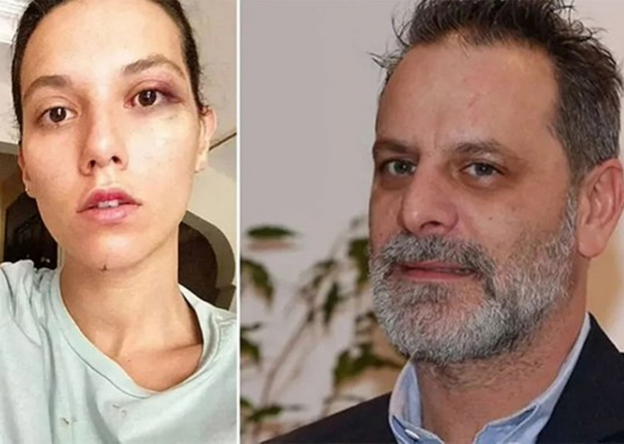Eski sevgilisi Deniz Bulutsuz'u darp eden Ozan Güven'in 11 yıl hapsi isteniyor
