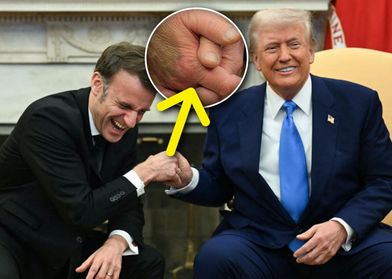 Trump'ın eline ne oldu? Gizemli morluk dikkat çekti! Macron ile tokalaşmasında ilginç detay...