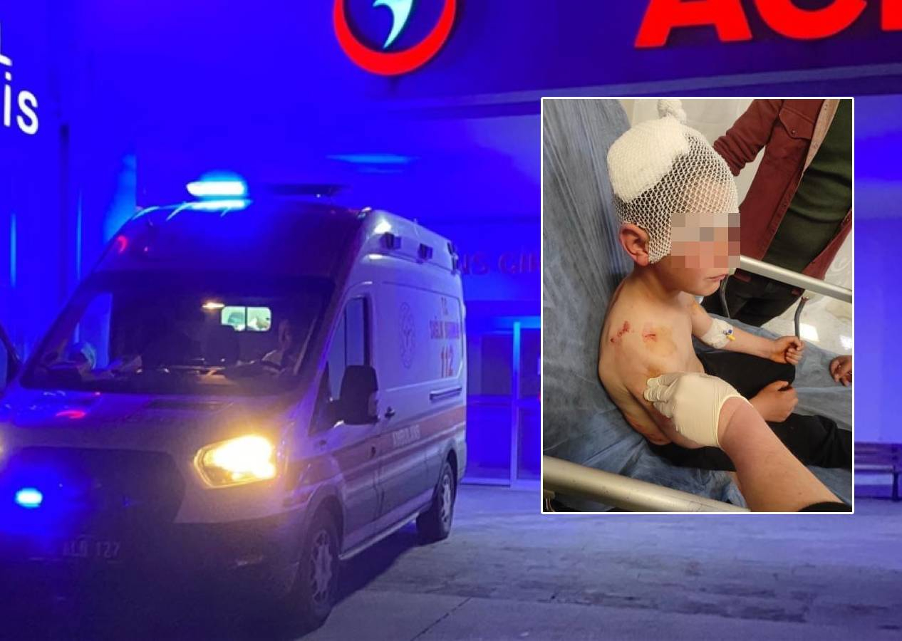 Isparta'da sokakta oynayan 9 yaşındaki çocuğa köpek saldırdı