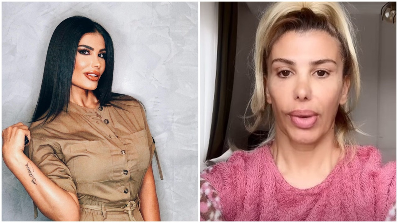 Botoks sonrası konuşmakta güçlük çekmişti! Hatice yaşadıklarını anlattı