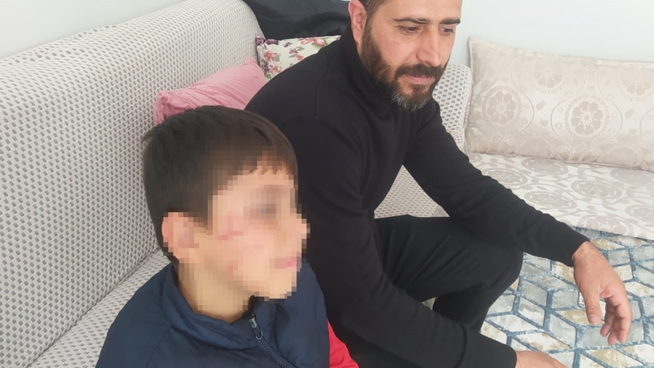 İlkokulda öğrencilerin kavgasına veliler de karıştı; 1 kişi yaralandı...