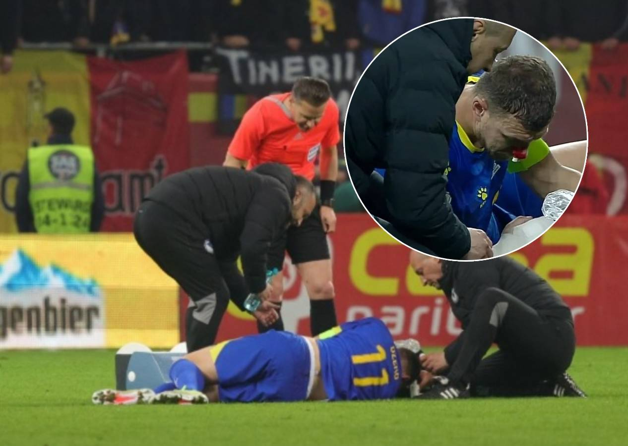 Edin Dzeko'nun Romanya - Bosna Hersek maçında burnu kırıldı
