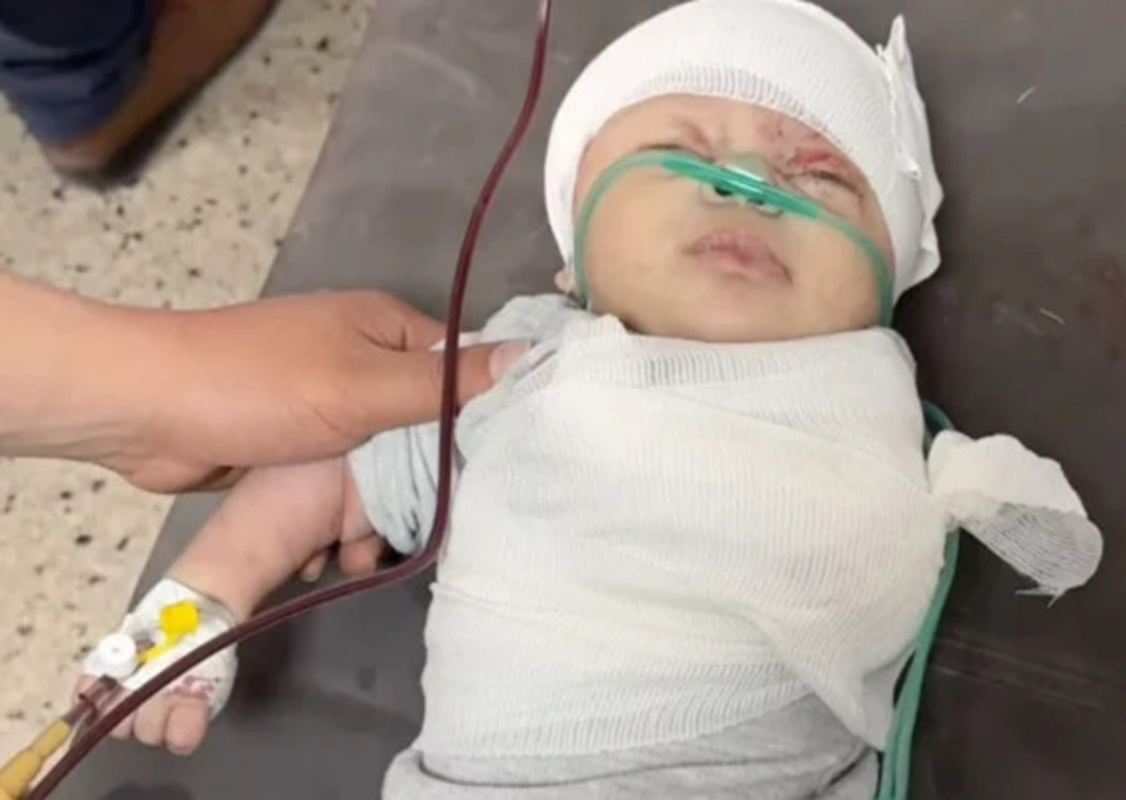 Bebek Katili İsrail! Saldırıda kolu kopan Gazzeli minik bebeğin son hali yürekleri burktu!